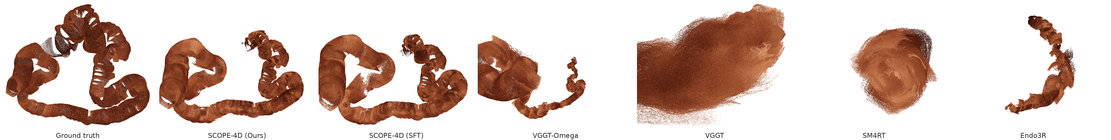 Colon 2 point clouds